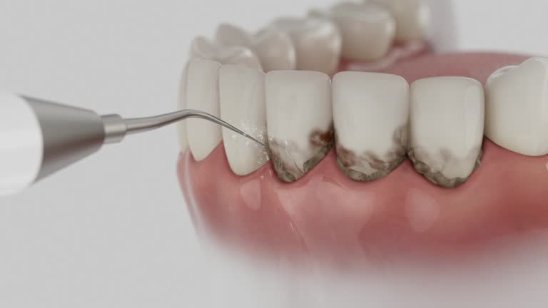 Reliable Dental contractor in Tippecanoe County County, IN by Dentist Open Now